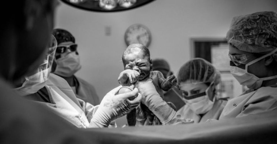 FOTO: Bayi Tidak Menangis Saat Lahiran (Pinterest: huffpost)